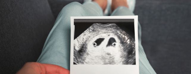 Symptômes d’une grossesse gémellaire