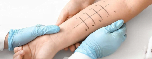 Traitement des allergies respiratoires