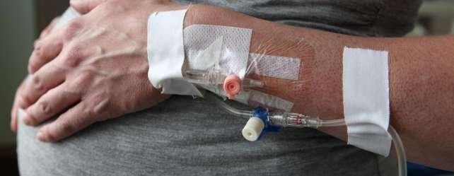 Déclenchement artificiel de l’accouchement