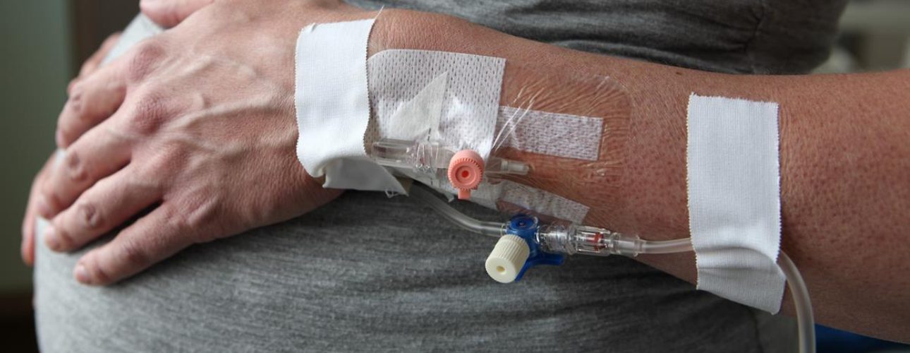 Déclenchement artificiel de l’accouchement