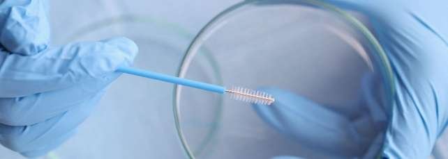 Frottis vaginal: un examen à ne pas négliger