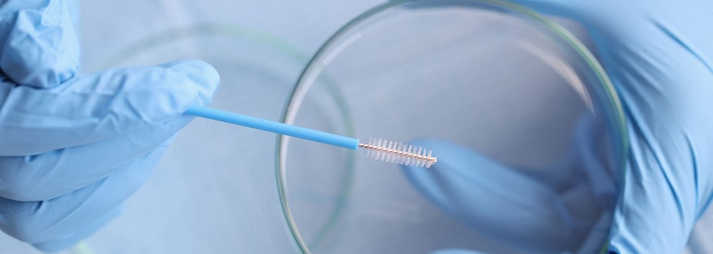 Frottis vaginal: un examen à ne pas négliger